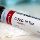 SALUTE PUBBLICA : COME MIGLIORARE IL "TESTING"