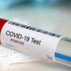 PER TRACCIARE IL VIRUS COVID-19, E BLOCCARNE LA DIFFUSIONE