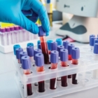 PUGLIA : SOTTOCOMMISSIONE LABORATORI ANALISI